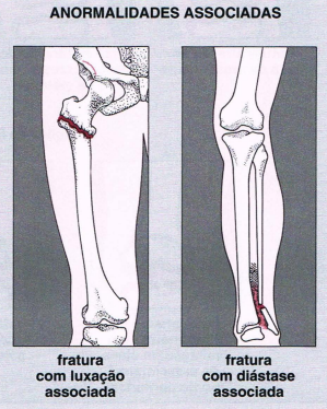 Avaliação Radiográfica das Fraturas
