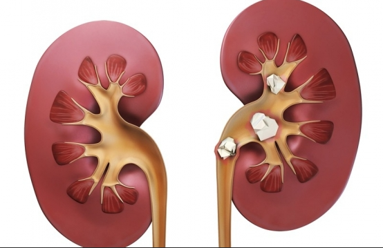 calcula renal