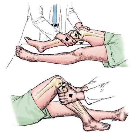 JOELHO – TESTE DE GAVETA ANTERIOR